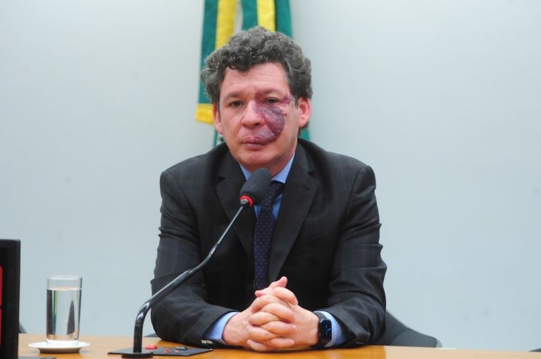 Lopes: 